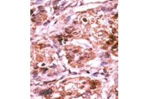 Image no. 2 for anti-Cell Division Cycle 25 Homolog A (S. Pombe) (CDC25A) (pSer293) antibody (ABIN358096)