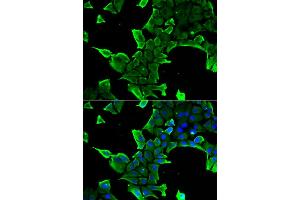Immunofluorescence analysis of A549 cells using NCS1 antibody. (NCS1 antibody)