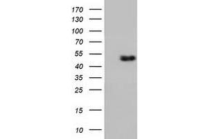 HEK293T cells were transfected with the pCMV6-ENTRY control (Left lane) or pCMV6-ENTRY RNH1 (Right lane) cDNA for 48 hrs and lysed. (RNH1 antibody)