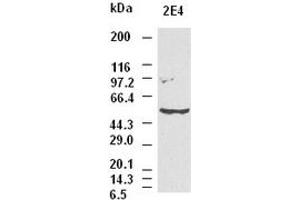 CK8 antibody (2E4) at 1:1000 dilution + Hela cell lysate (KRT8 antibody  (AA 91-381))