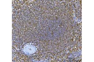 IHC analysis of IRF7 using anti-IRF7 antibody (ABIN7601022). (IRF7 antibody  (AA 27-503))