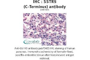 Image no. 1 for anti-Somatostatin Receptor 5 (SSTR5) (C-Term) antibody (ABIN1739676) (SSTR5 antibody  (C-Term))