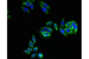 Immunofluorescent analysis of HepG2 cells using ABIN7174836 at dilution of 1:100 and Alexa Fluor 488-congugated AffiniPure Goat Anti-Rabbit IgG(H+L) (C3orf18 antibody  (AA 83-162))
