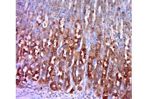 Paraformaldehyde-fixed, paraffin embedded rat stomach, Antigen retrieval by boiling in sodium citrate buffer (pH6. (Hexokinase 1 antibody  (AA 501-600))