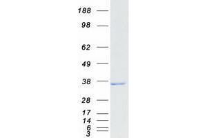 Western Blotting (WB) image for Retinol Dehydrogenase 11 (All-Trans/9-Cis/11-Cis) (RDH11) protein (Myc-DYKDDDDK Tag) (ABIN2730662)