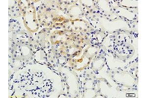 Formalin-fixed and paraffin embedded: rat kidney tissue labeled with Anti-PKCB Polyclonal Antibody, Unconjugated (ABIN727010) at 1:200, followed by conjugation to the secondary antibody and DAB staining (PKC beta antibody  (AA 601-673))