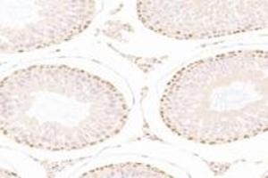 Immunohistochemistry analysis of paraffin-embedded rat testis using,PARIS (ABIN7076272) at dilution of 1: 3000