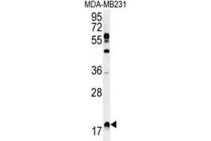 Western Blotting (WB) image for anti-Ras Homolog Enriched in Brain (RHEB) antibody (ABIN2996362) (RHEB antibody)