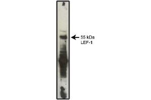 Western Blotting (WB) image for anti-Lymphoid Enhancer-Binding Factor 1 (LEF1) antibody (ABIN953159) (LEF1 antibody)