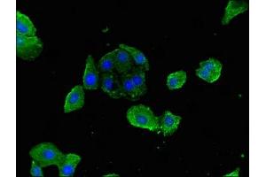 Immunofluorescence staining of HepG2 cells with ABIN7158609 at 1:200, counter-stained with DAPI. (LYVE1 antibody  (AA 20-238))