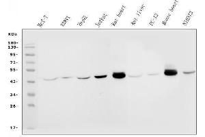 Western blot analysis of IDH2 using anti-IDH2 antibody (ABIN7602786).