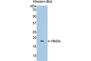 Detection of Recombinant ANXA2, Human using Polyclonal Antibody to Annexin A2 (ANXA2) (Annexin A2 antibody  (AA 1-339))