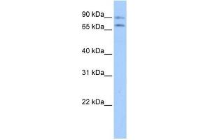 Junctophilin 2 antibody used at 1 ug/ml to detect target protein.