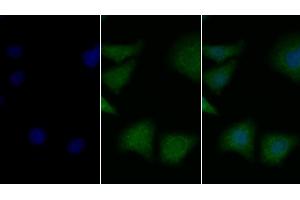Detection of BDNF in Human Hela cell using Polyclonal Antibody to Brain Derived Neurotrophic Factor (BDNF) (BDNF antibody  (AA 139-249))