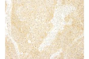 Immunohistochemistry (IHC) image for anti-Breast Cancer Anti-Estrogen Resistance 1 (BCAR1) (AA 275-325) antibody (ABIN7448429) (BCAR1 antibody  (AA 275-325))
