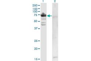 Western Blot analysis of RARS expression in transfected 293T cell line by RARS monoclonal antibody (M02), clone 1A2. (RARS antibody  (AA 1-660))