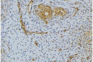 ABIN6276594 at 1/100 staining Human uterus tissue by IHC-P. (HGF antibody  (Internal Region))