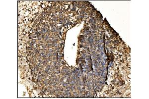 IHC analysis of Arginine Decarboxylase/AZIN2 using anti-Arginine Decarboxylase/AZIN2 antibody (ABIN7599403). (ADC antibody  (AA 1-448))