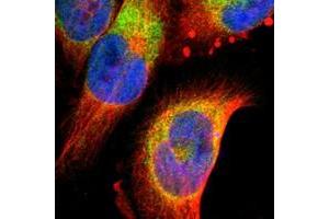 Immunofluorescent staining of human cell line U-251 MG with FNDC3B polyclonal antibody  at 1-4 ug/mL dilution shows positivity in endoplasmic reticulum. (FNDC3B antibody)