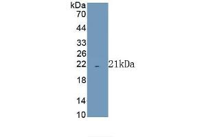 Detection of Recombinant COX4I1, Human using Polyclonal Antibody to Cytochrome C Oxidase Subunit IV Isoform 1 (COX4I1) (COX IV antibody  (AA 1-169))