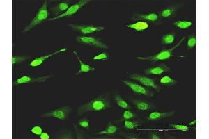 Immunofluorescence of monoclonal antibody to SMAD7 on HeLa cell. (SMAD7 antibody  (AA 160-260))