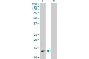 Western Blot analysis of SMA4 expression in transfected 293T cell line by SMA4 MaxPab polyclonal antibody. (SMN1 antibody  (AA 1-140))