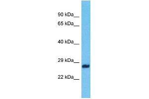 Western Blotting (WB) image for anti-Zinc Finger, CCHC Domain Containing 9 (ZCCHC9) (C-Term) antibody (ABIN2788488) (ZCCHC9 antibody  (C-Term))