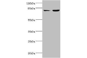 Western blot All lanes: ACSL4 antibody at 2 μg/mL Lane 1: HepG2 whole cell lysate Lane 2: Hela whole cell lysate Secondary Goat polyclonal to rabbit IgG at 1/10000 dilution Predicted band size: 80, 75 kDa Observed band size: 80 kDa