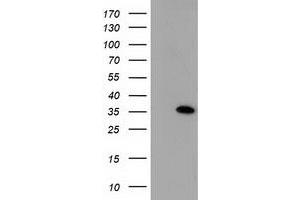 Image no. 1 for anti-Sulfotransferase Family, Cytosolic, 1A, Phenol-Preferring, Member 1 (SULT1A1) antibody (ABIN1501225)