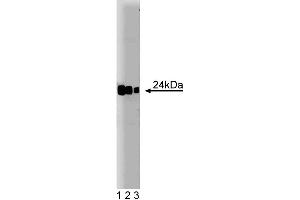 Western blot analysis of Rab8 on a Jurkat cell lysate. (RAB8A antibody  (AA 84-205))
