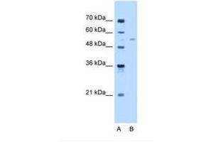 Image no. 1 for anti-Fatty Acyl CoA Reductase 2 (FAR2) (AA 401-450) antibody (ABIN6738351) (FAR2 antibody  (AA 401-450))