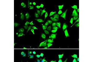 Immunofluorescence analysis of A549 cells using FKBP8 Polyclonal Antibody (FKBP8 antibody)