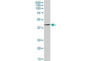HOMER1 MaxPab rabbit polyclonal antibody. (HOMER1 antibody  (AA 1-354))