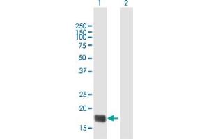Western Blot analysis of TMEM86B expression in transfected 293T cell line by TMEM86B MaxPab polyclonal antibody. (TMEM86B antibody  (AA 1-226))