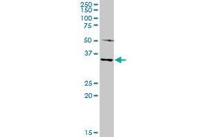 MAGEA4 MaxPab rabbit polyclonal antibody. (MAGEA4 antibody  (AA 1-317))