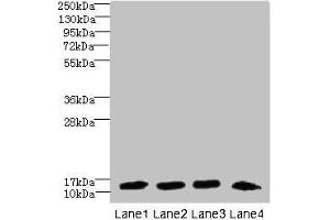 Western blot All lanes: DNAL4 antibody at 1. (DNAL4 antibody  (AA 1-105))