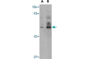 Western blot analysis of DHX58 in rat kidney tissue lysate with DHX58 polyclonal antibody  at (A) 1 and (B) 2 ug/mL . (DHX58 antibody  (C-Term))
