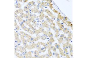 Immunohistochemistry of paraffin-embedded human liver injury using CETN3 antibody at dilution of 1:100 (x40 lens).