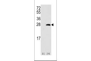 Western blot analysis of OPRS1 using rabbit polyclonal OPRS1 Antibody. (SIGMAR1 antibody  (AA 118-147))