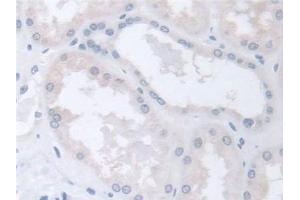 Detection of CCT2 in Human Kidney Tissue using Polyclonal Antibody to Chaperonin Containing TCP1, Subunit 2 (CCT2)