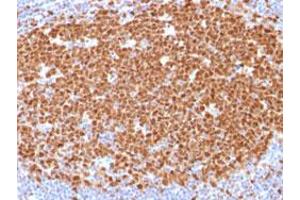 Immunohistochemical staining (Formalin-fixed paraffin-embedded sections) of human tonsil with MCM7 monoclonal antibody, clone MCM7/1468 . (MCM7 antibody  (AA 195-319))