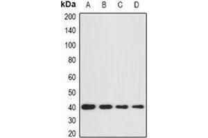 Western blot analysis of GNA11 expression in BT474 (A), SKOV3 (B), mouse brain (C), mouse kidney (D) whole cell lysates. (GNA11 antibody)
