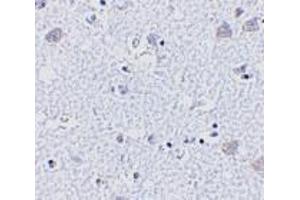 Immunohistochemistry of BRSK1 in human brain tissue with BRSK1 antibody at 5 μg/ml. (BRSK1 antibody  (Center))