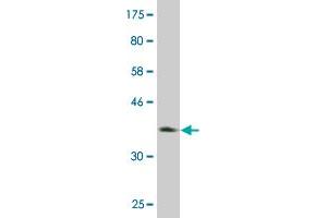 Western Blot detection against Immunogen (36. (Peroxiredoxin 4 antibody  (AA 51-150))