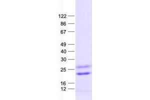 Validation with Western Blot (C3ORF36 Protein (His tag))