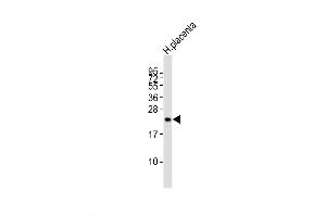 Western Blot at 1:2000 dilution + human placenta lysates Lysates/proteins at 20 ug per lane. (CGB antibody  (C-Term))