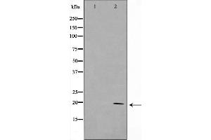 TAF9 antibody  (Internal Region)