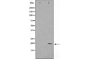 Western blot analysis on HepG2 cell lysate using KAD6 Antibody，The lane on the left is treated with the antigen-specific peptide. (TAF9 antibody  (Internal Region))