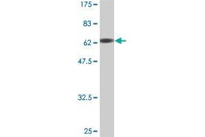 Western Blot detection against Immunogen (67. (MEIS2 antibody  (AA 1-381))