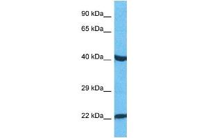 Host:  Rabbit  Target Name:  PAX3  Sample Type:  HepG2 Whole Cell lysates  Antibody Dilution:  1. (Paired Box 3 antibody  (C-Term))